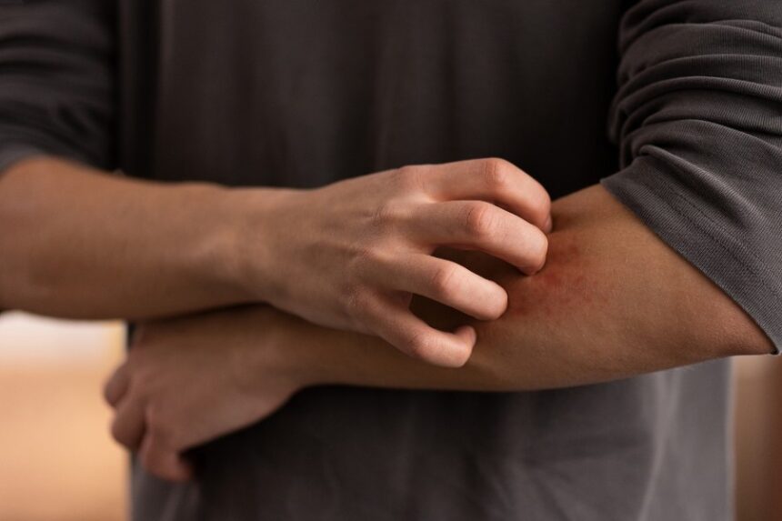 Things to Know About Chafing and How to Prevent It Fast