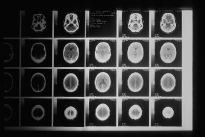 Doctorhub360.com Neurological Diseases