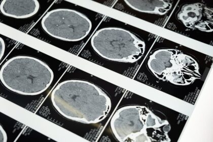 Neurodivergent Test