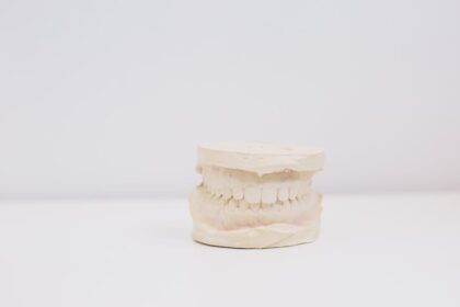 The Psychological Effects of Misaligned Teeth Among Individuals in Kelowna